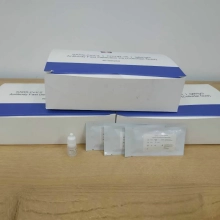 Sars-cov-2 COVID-19 (IgG/IgM) Antibody Fast Detection Kit (Colloidal Gold) China Factory wholesale